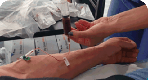 Preparazione di plasma ricco di piastrine