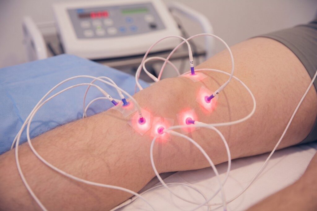 Laserneedle sul ginocchio, senza aghi