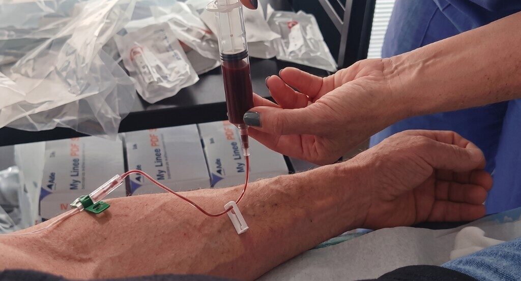 Prelievo di sangue per il plasma ricco di piastrine
